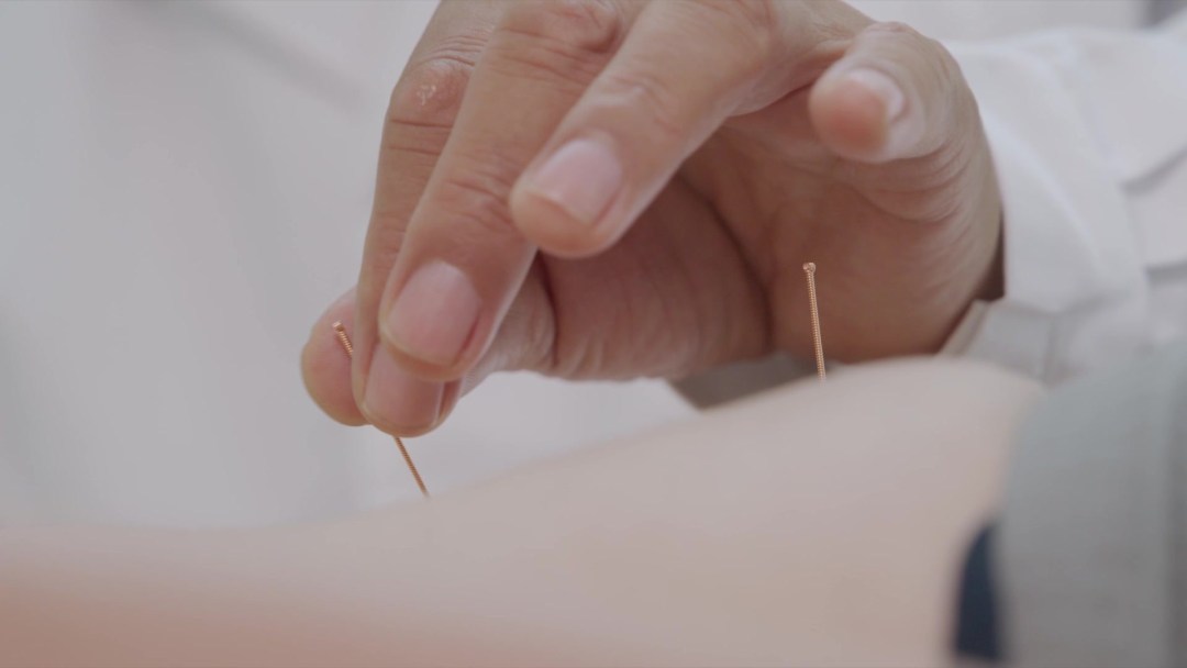 读懂中医四大经典 | 第六课：轻轻一捻如被电击 针灸讲究“得气”