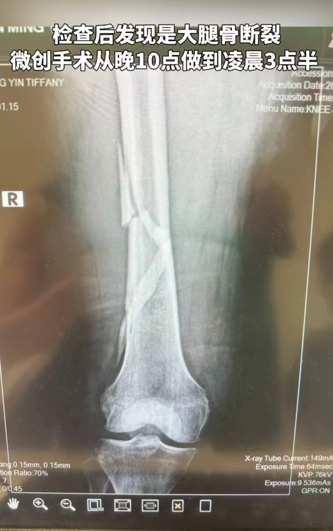 1714118649460140.png 图片