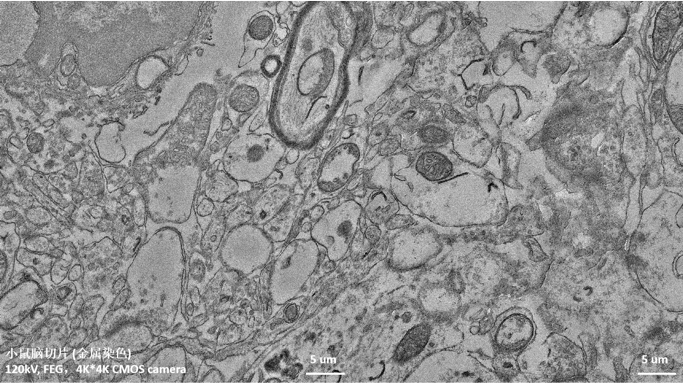 【稿件配图】TH—F120“太行”应用案例:小鼠脑切片