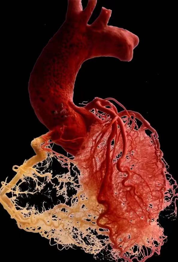 1978年,钟世镇制作的首个心血管铸型标本