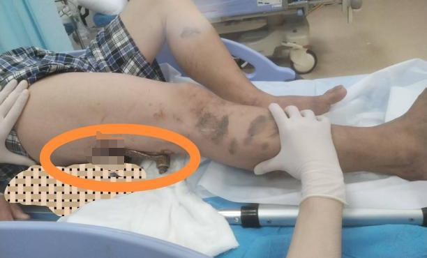 微信图片编辑_20250718185527