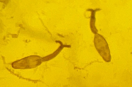 △日本血吸虫尾蚴(图源:中国疾控中心)