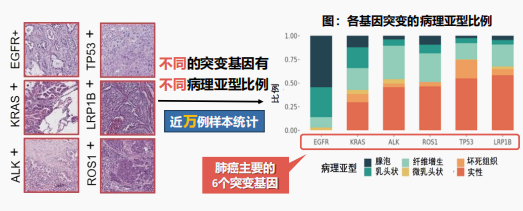 图为基因突变下肺癌病理形态变化